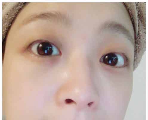 鈴木奈々、一重から二重に 比較写真を公開