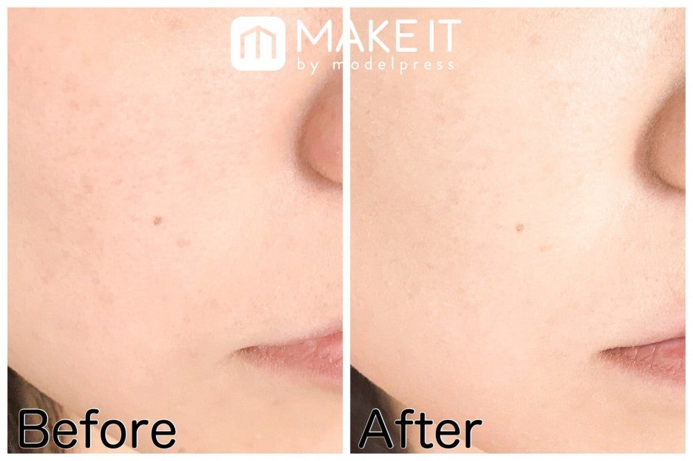 Before：素肌 After：WHOMEE／リキッドファンデーション／ナチュラル 使用 (C)メイクイット