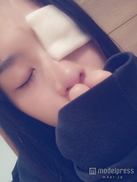 画像3/13) 斜視手術後“初の撮影” 再スタート直前の仮面女子