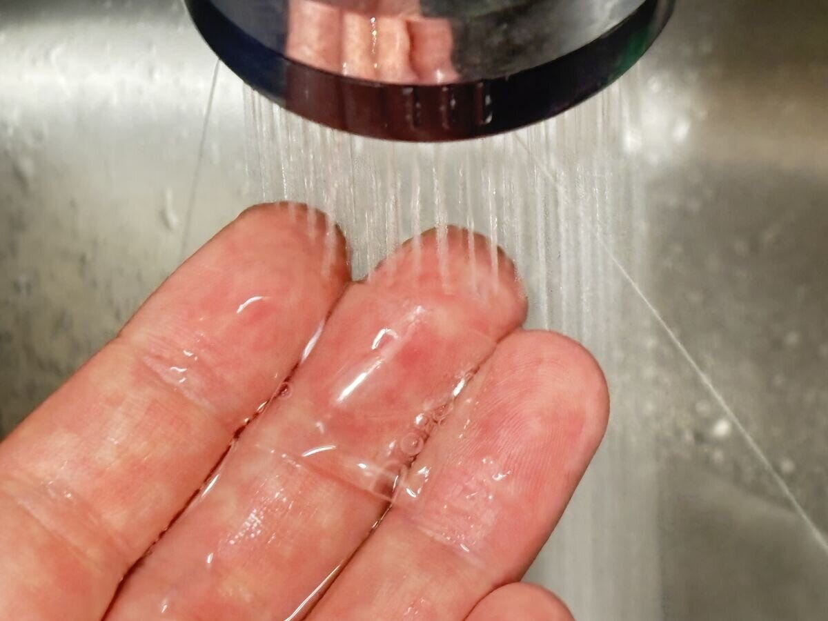 指に貼り付けた透明なゲルパッドを水道水で洗っている様子