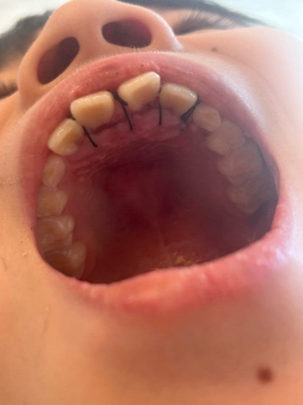 遠藤章造の次男／ココリコ遠藤嫁オフィシャルブログより