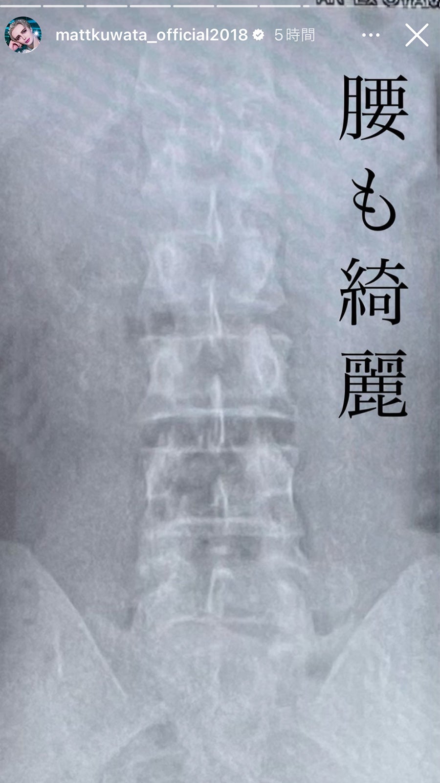 Matt、Instagramストーリーズより