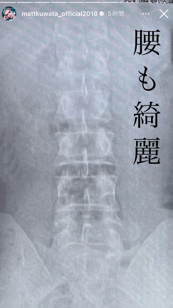 Matt、Instagramストーリーズより