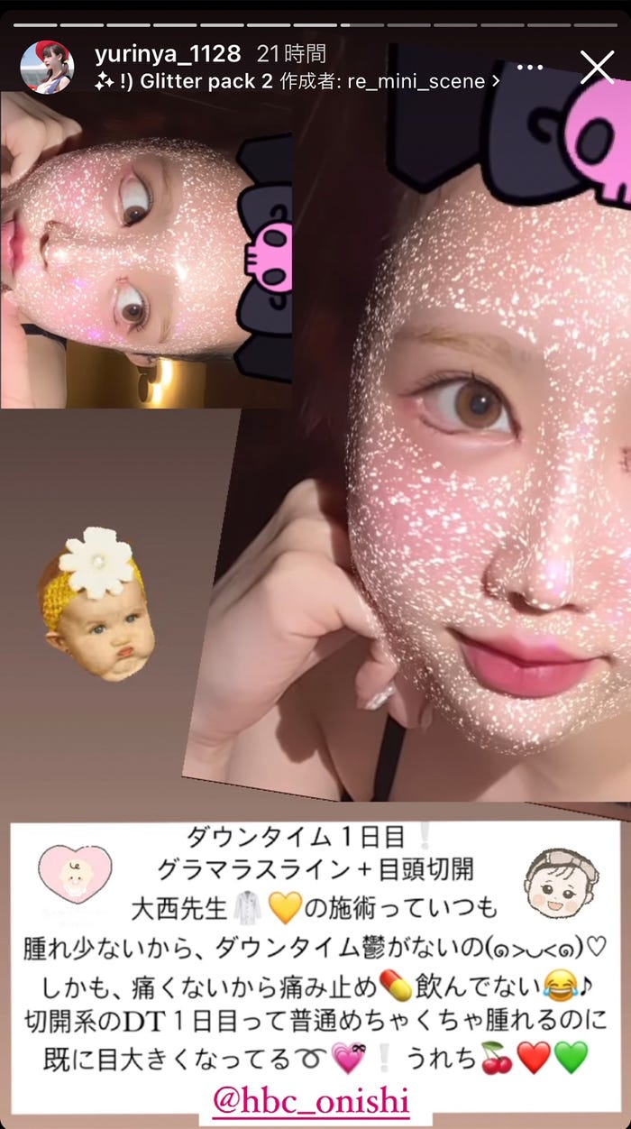 ゆりにゃInstagramストーリーズより