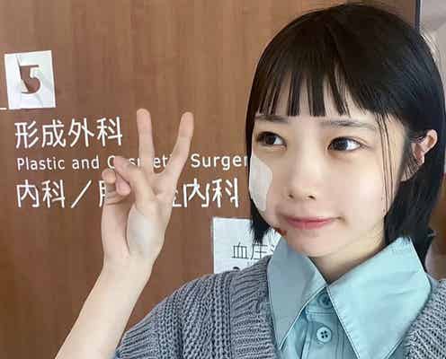 あの、バイク転倒で顔を骨折「パンパンになっちゃった」