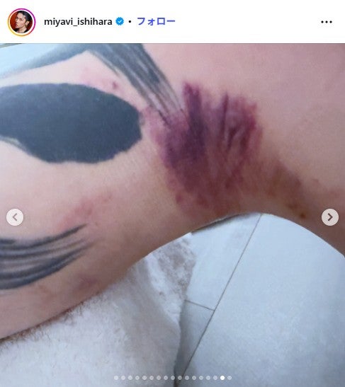 MIYAVI Instagramより
