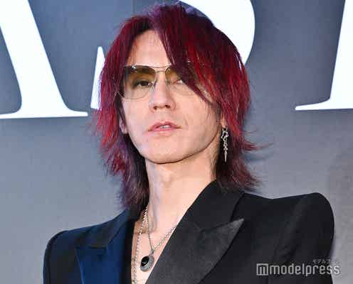 SUGIZO「FNS歌謡祭」骨折したまま生出演していた「どおりで傷みが…」