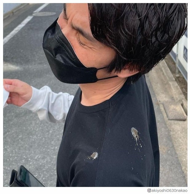 中尾明慶、YouTube撮影前に“まさかのハプニング”「逆についてる」「やっぱり持ってる」の声