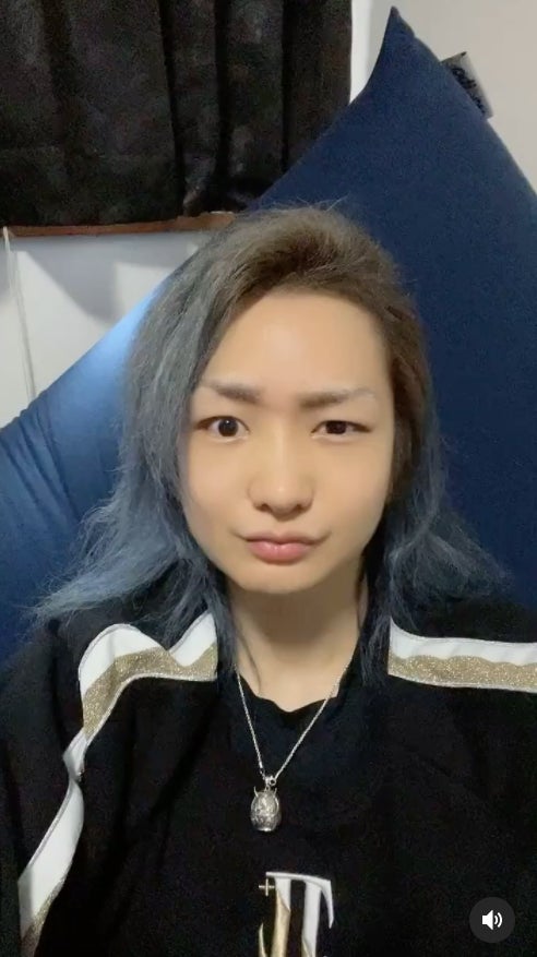 “総額250万整形”のDJ社長、ダウンタイムの経過報告に反響「面影ありつつイケメン」