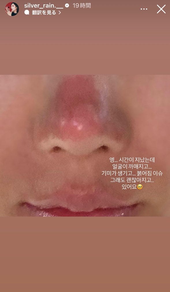 クォン・ウンビInstagramより