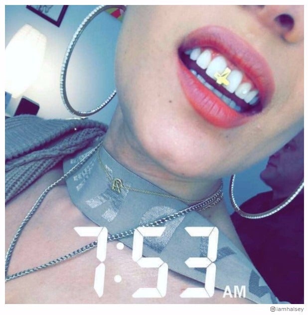 “歯のピアス”が話題沸騰 海外セレブがこぞって愛用するNEXTトレンド