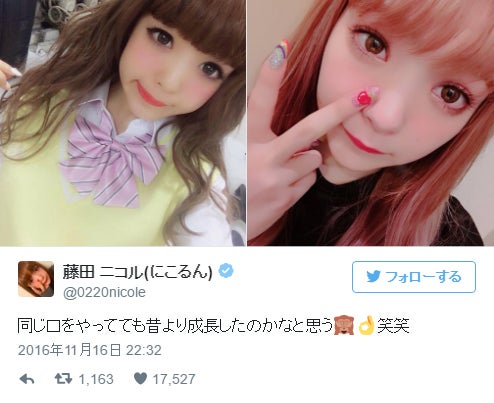 にこるんの成長がすごい ビフォーアフターに 本当痩せた 大人になった と納得の声 モデルプレス にこるんの成長がすごい ビフォーアフターに 本当痩せた 大人になった と納得の声 モデルプレス