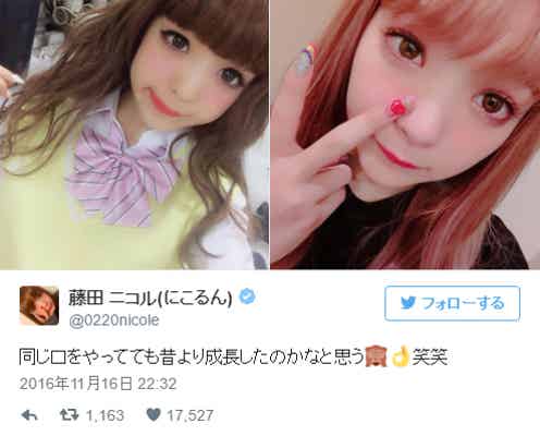 にこるんの成長がすごい ビフォーアフターに「本当痩せた」「大人になった」と納得の声