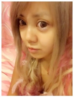 顔の全面整形後のはるたむ/オフィシャルブログより