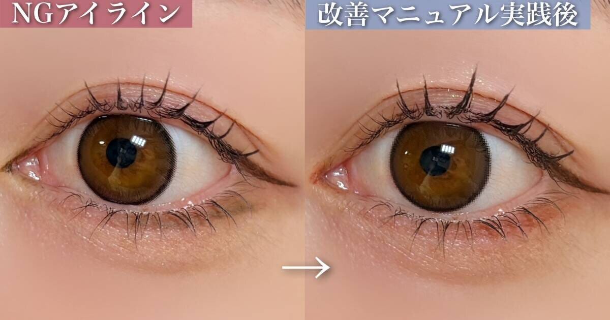 切開ライン　改善前　改善後