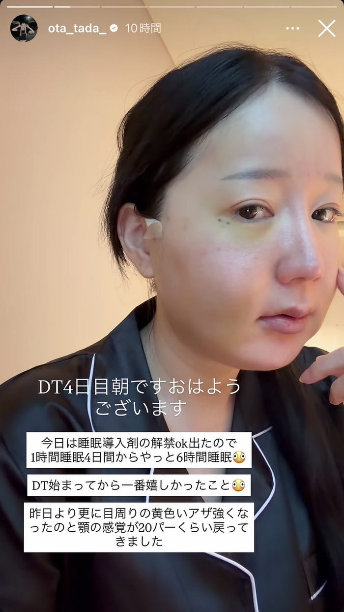 多田さんInstagramストーリーズより