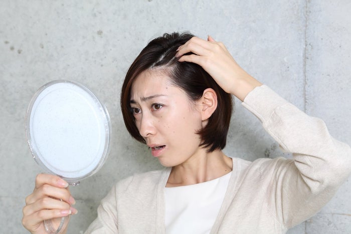 ボリューム不足 髪型がきまらない 40代から女性の薄毛の悩みが深刻化する原因と対策 モデルプレス