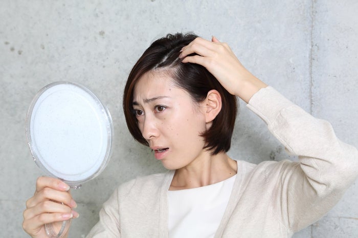 ボリューム不足 髪型がきまらない 40代から女性の薄毛の悩みが深刻化する原因と対策 モデルプレス ボリューム不足 髪型がきまらない 40代から女性の薄毛の悩みが深刻化する原因と対策 モデルプレス