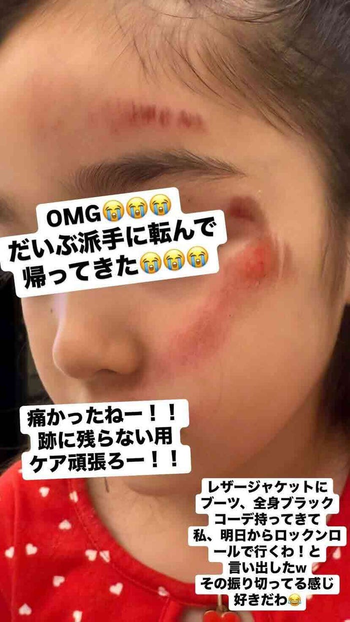 紅蘭Instagramストーリーズより