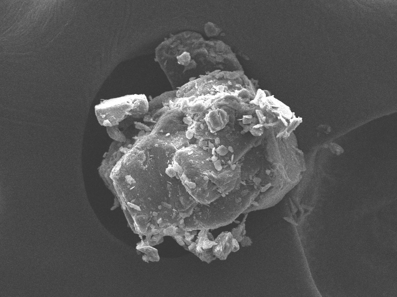 トラネキサム酸を電子顕微鏡で数百倍に拡大
