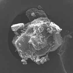 トラネキサム酸を電子顕微鏡で数百倍に拡大