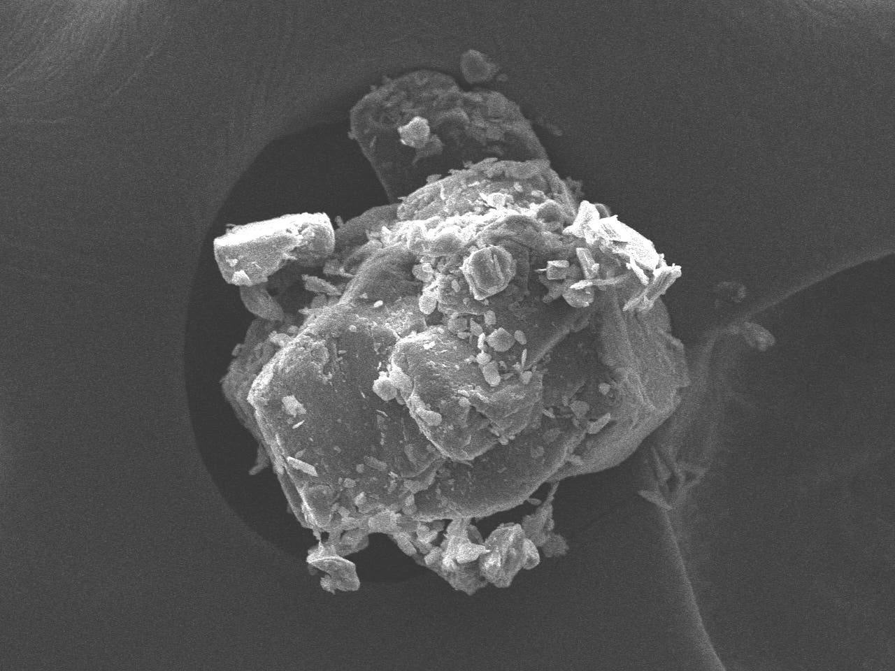 トラネキサム酸を電子顕微鏡で数百倍に拡大