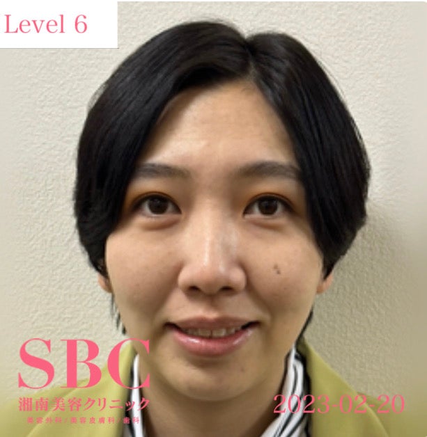 はる／二重シミュレーションの様子（提供写真）