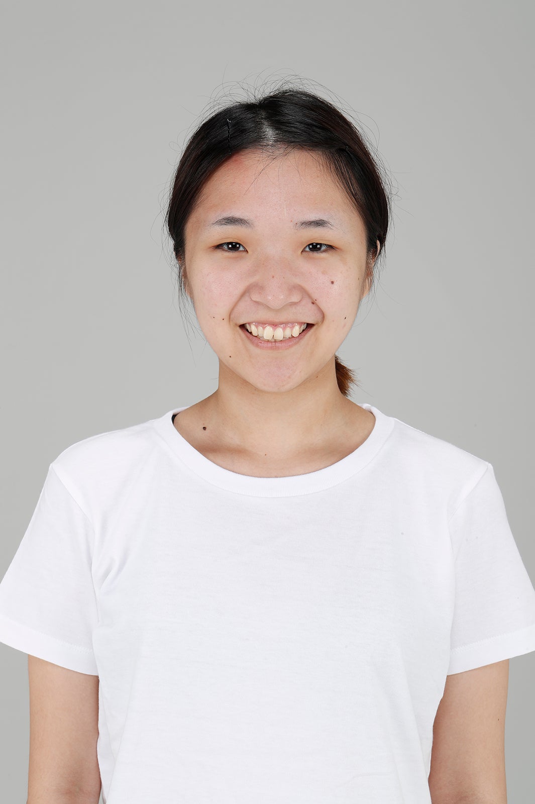 整形シンデレラオーディション／整形前 （提供写真）