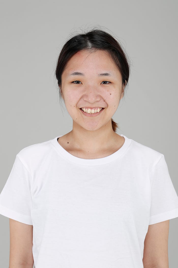 整形シンデレラオーディション/整形前 (提供写真)