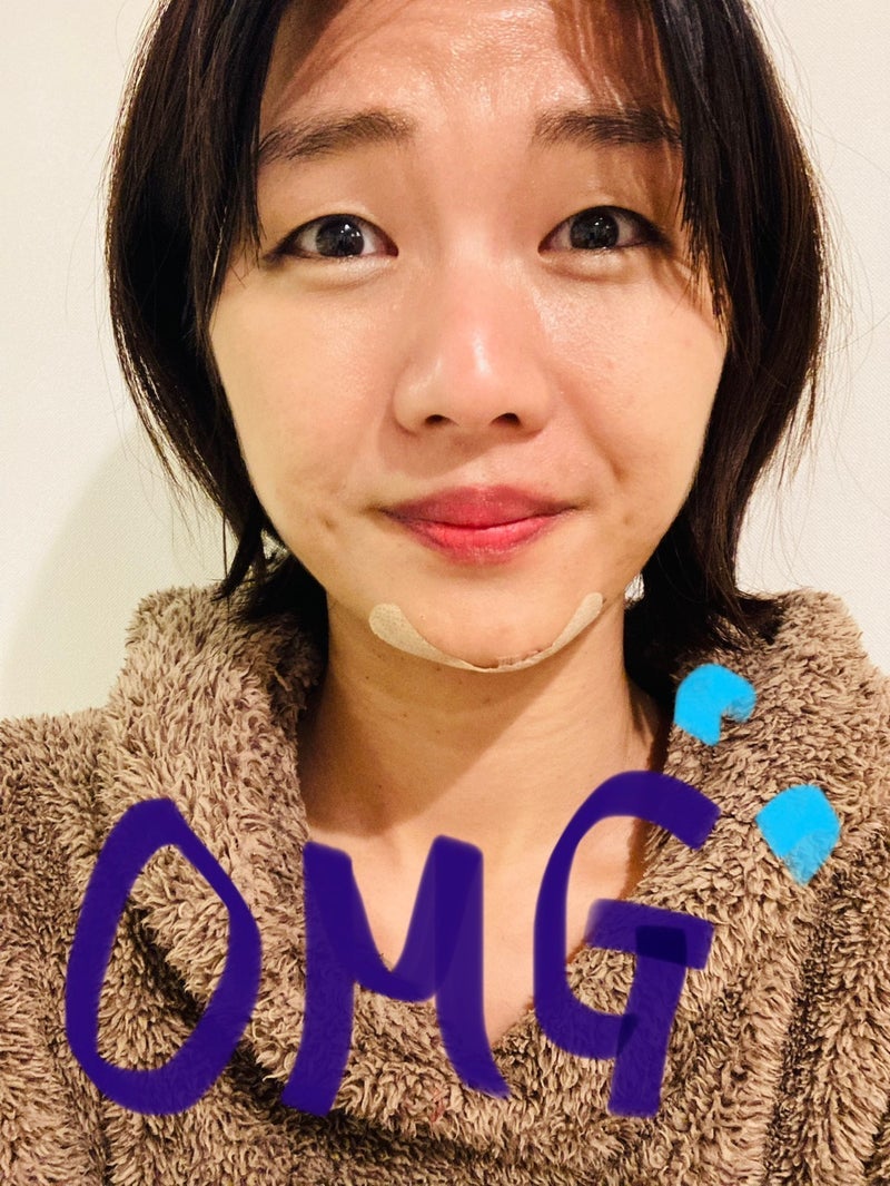 怪我の様子／ゆりえオフィシャルブログより