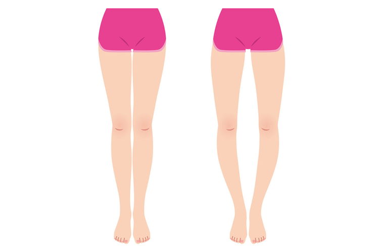 O脚を改善するために意識してほしいたった1つのこととは?