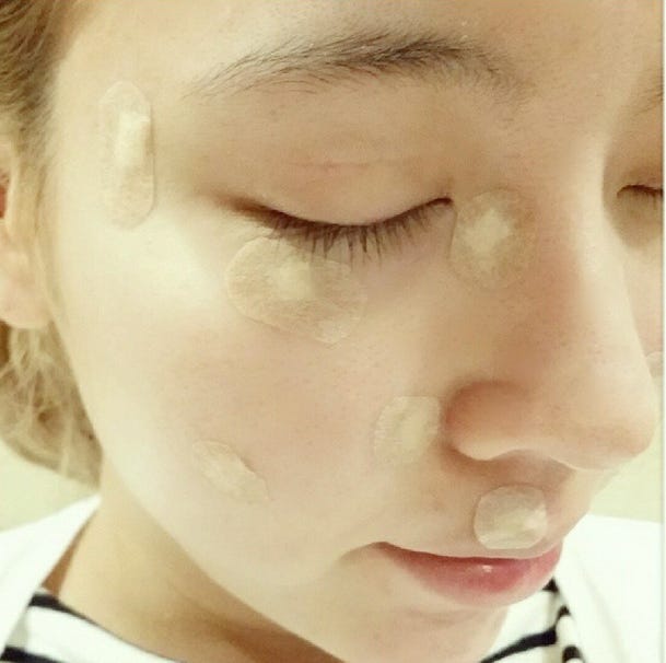 ホクロ除去完了後の姿を公開/吉川ちかInstagramより