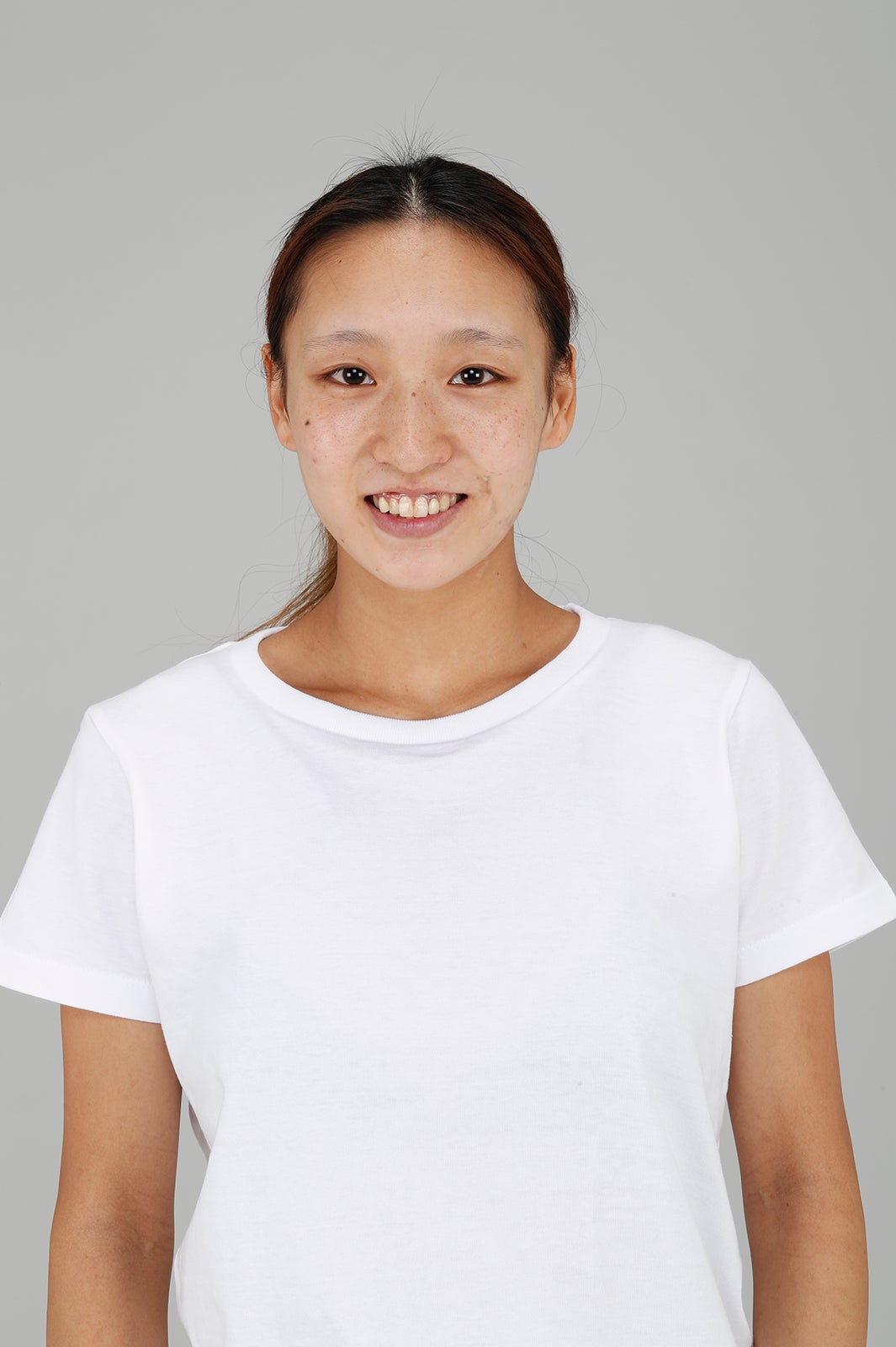 山田麻莉亜さん／整形前 （提供写真）