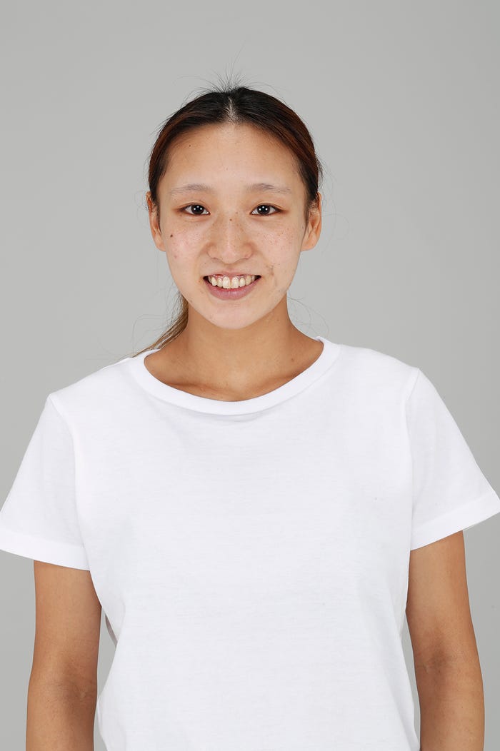 山田麻莉亜さん/整形前 (提供写真)