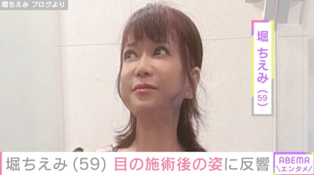 堀ちえみ（59）、目の施術後の姿に反響 「お目目 パッチリ」「本当に綺麗に上がってますね」などの声