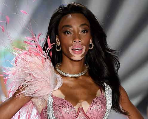 世界一美しい「まだら肌」ウィニー・ハーロウ、悲願の初出演で多様性広げる<ヴィクトリアズ・シークレット ファッションショー2018>