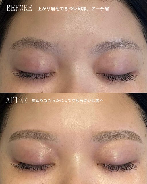 左右差の解消方法　完成