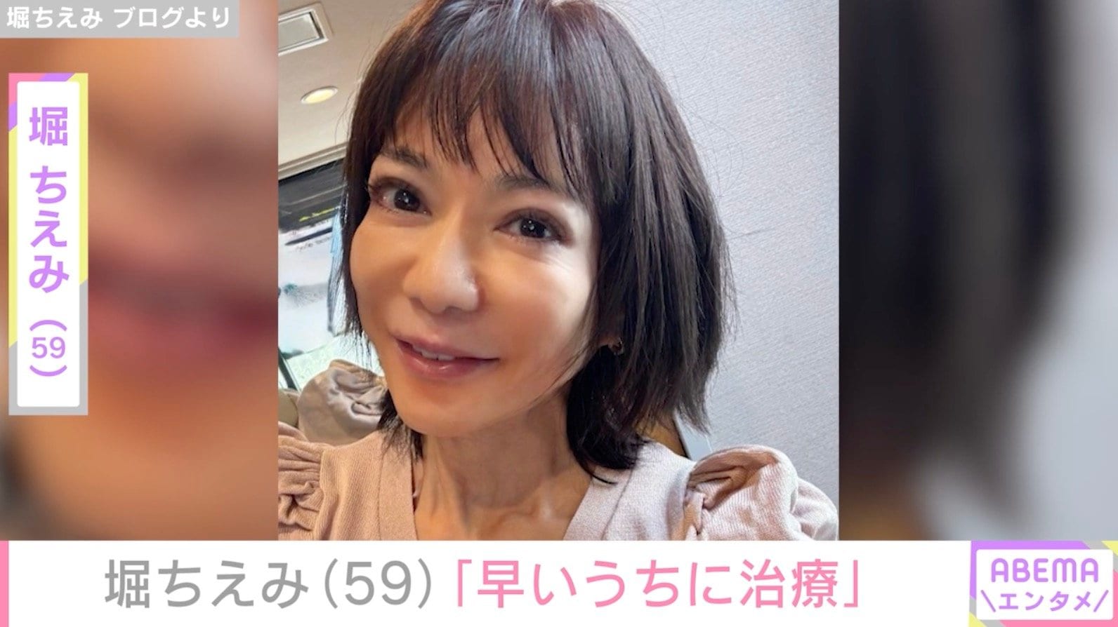 「侮れない」堀ちえみ（59）、臀部の治療を受けたことを報告
