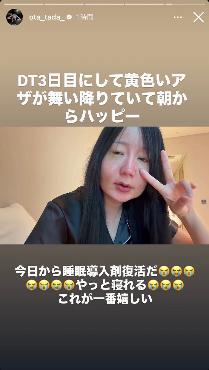 多田さんInstagramストーリーズより