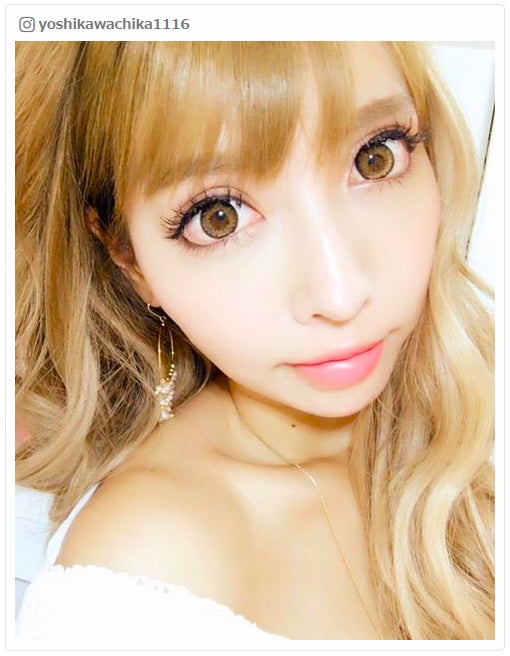 整形公表の双子モデル・吉川ちか、新たな施術を決意「何言われたって自分の人生」