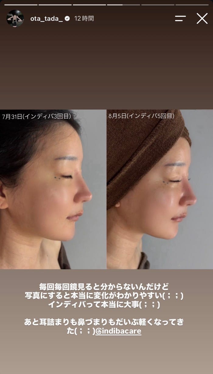 多田さんInstagramストーリーズより