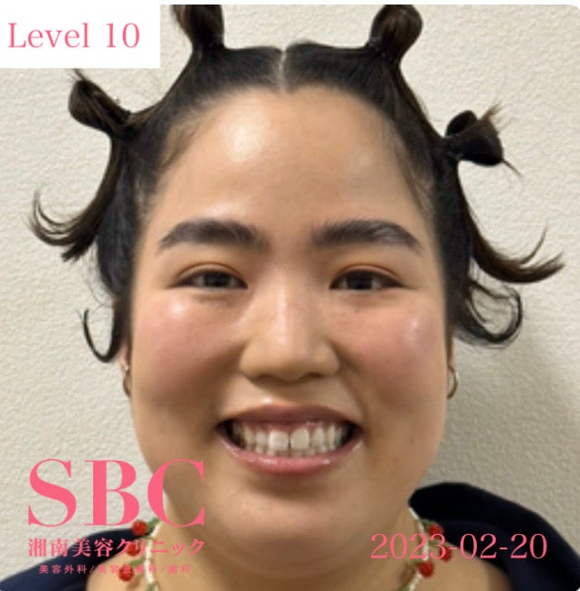 ゆりやんレトリィバァ／二重シミュレーションの様子（提供写真）