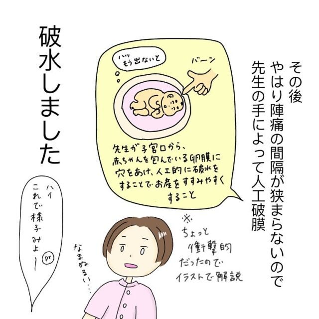 5】今すぐ入院！だけど全然破水しなくてu2026「こんなやり方あるの 