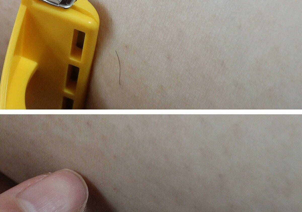 肌に生えた一本の毛とカミソリの刃先が写る 肌に生えた一本の毛とカミソリの刃先が写る