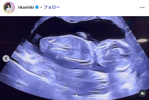 椎木里佳さんInstagramより