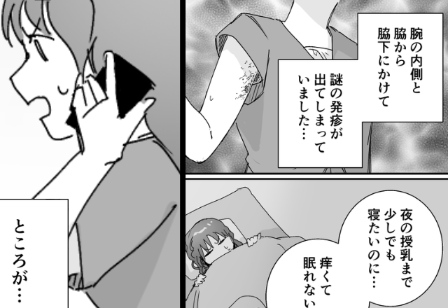 産後の疲れで…「ナゾの発疹！？」痒みで眠れぬ嫁。限界寸前の中⇒『もしもし…？』1本の電話が【事態】を悪化させたワケ