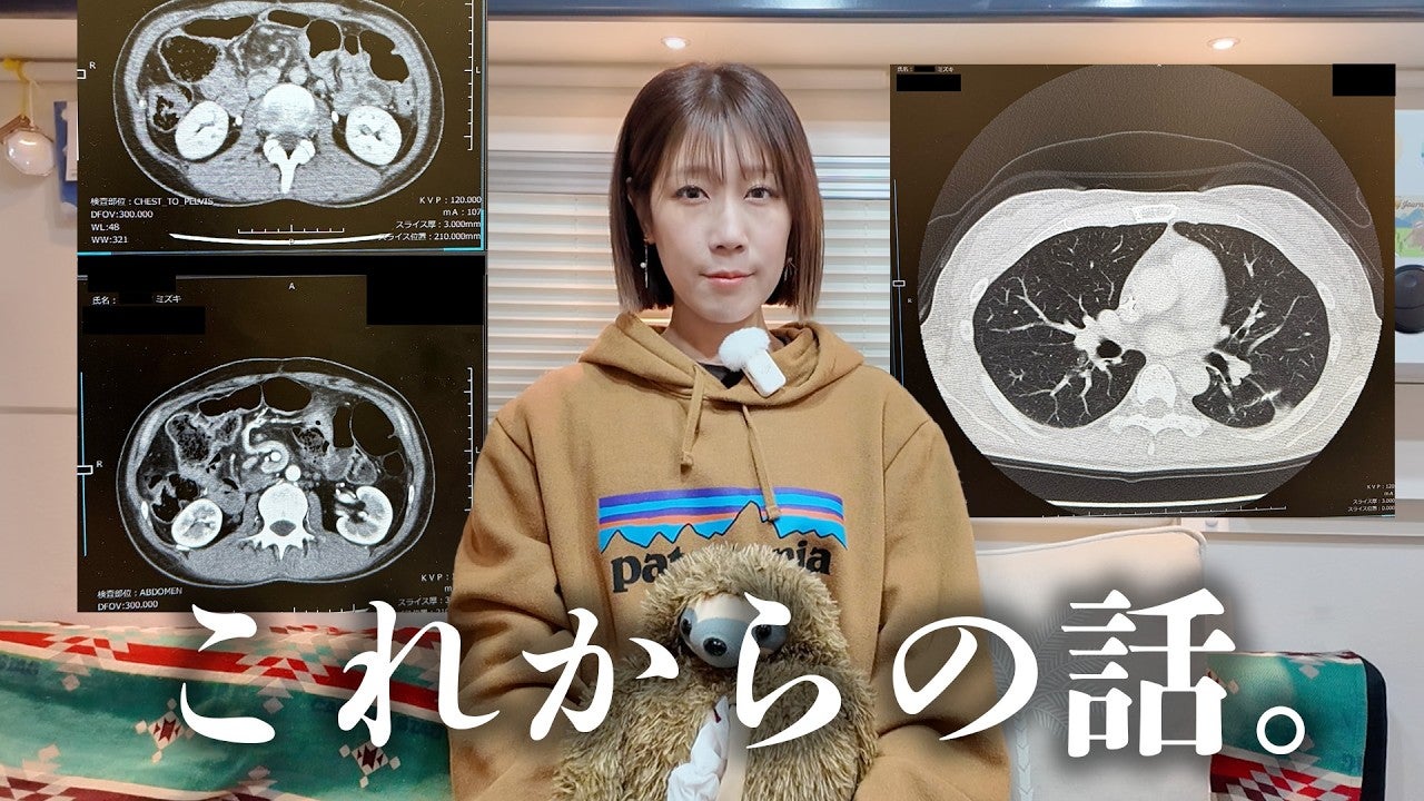 膵臓がんを患うYouTuber、CTの結果を受けて今後について重要なことを語る