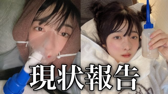 美人YouTuber・Rちゃん、壮絶整形告白「生死を彷徨った」術後の様子