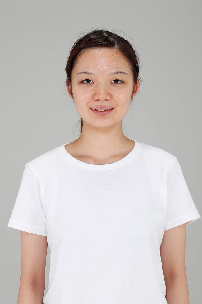 加藤叶華さん/整形前 (提供写真)