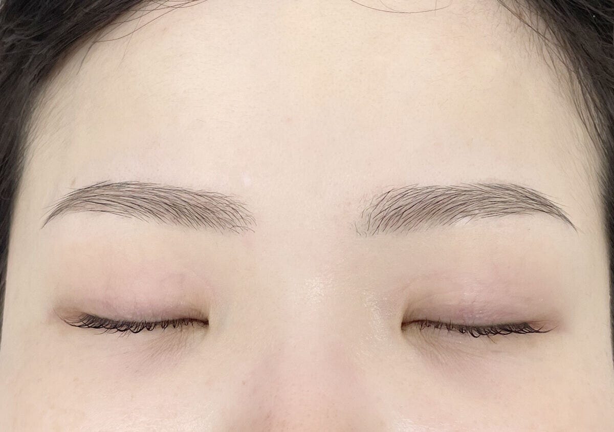 左右の高さのちがう眉 左右の高さのちがう眉